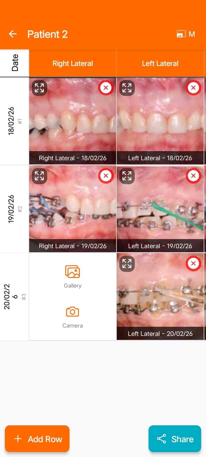 Ortho Images Chart